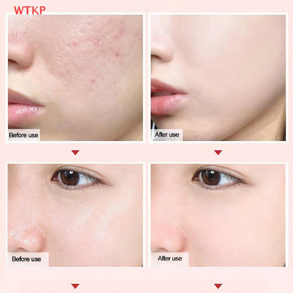 PRIMER PARA POROS INVISIBLES IC