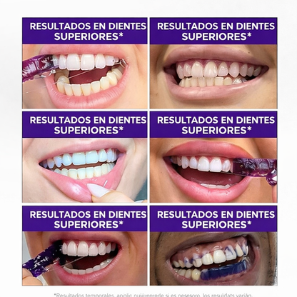 TIRA BLANQUEADORA DENTAL PAGA 2 LLEVA 3 Cajas
