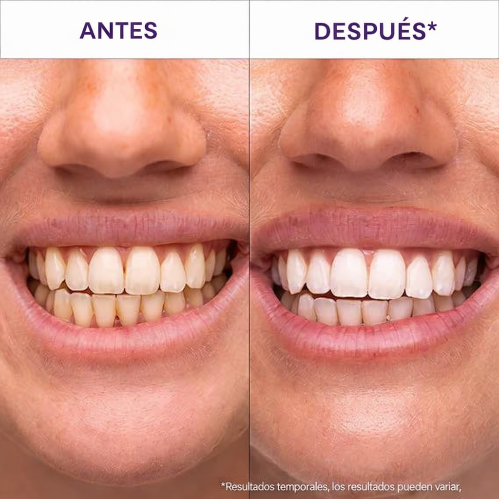 TIRA BLANQUEADORA DENTAL PAGA 2 LLEVA 3 Cajas