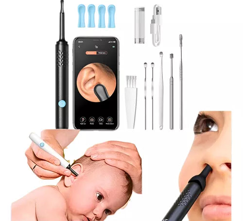 Otoscopio para oido con Cámara