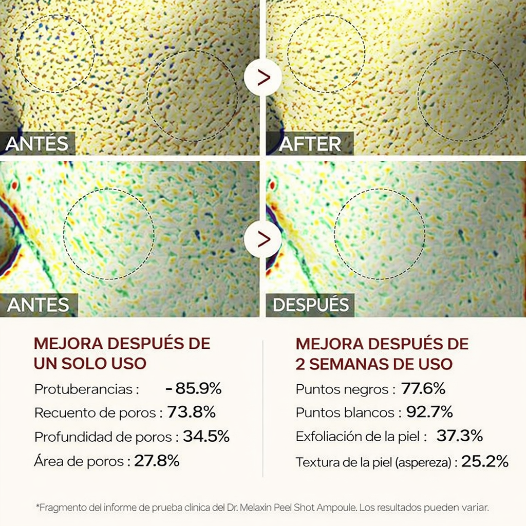 Dr.Melaxin Peel Shot Glow  Exfoliante de Arroz 80ml Exfoliante Facial y Corporal Removedor de Puntos Negros