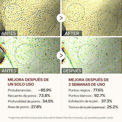 Dr.Melaxin Peel Shot Glow  Exfoliante de Arroz 80ml Exfoliante Facial y Corporal Removedor de Puntos Negros